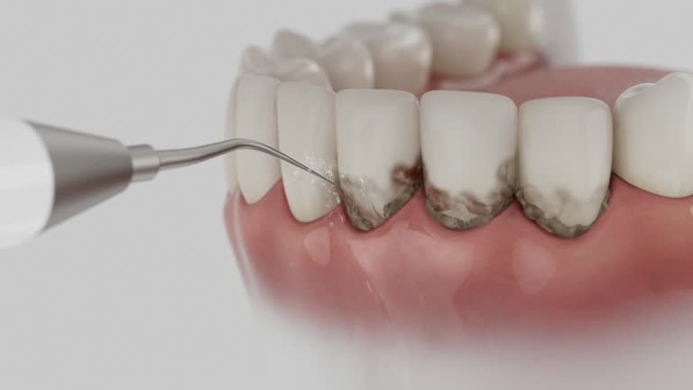 Reliable Dental contractor in Cutlerville, MI by Dentist Open Now
